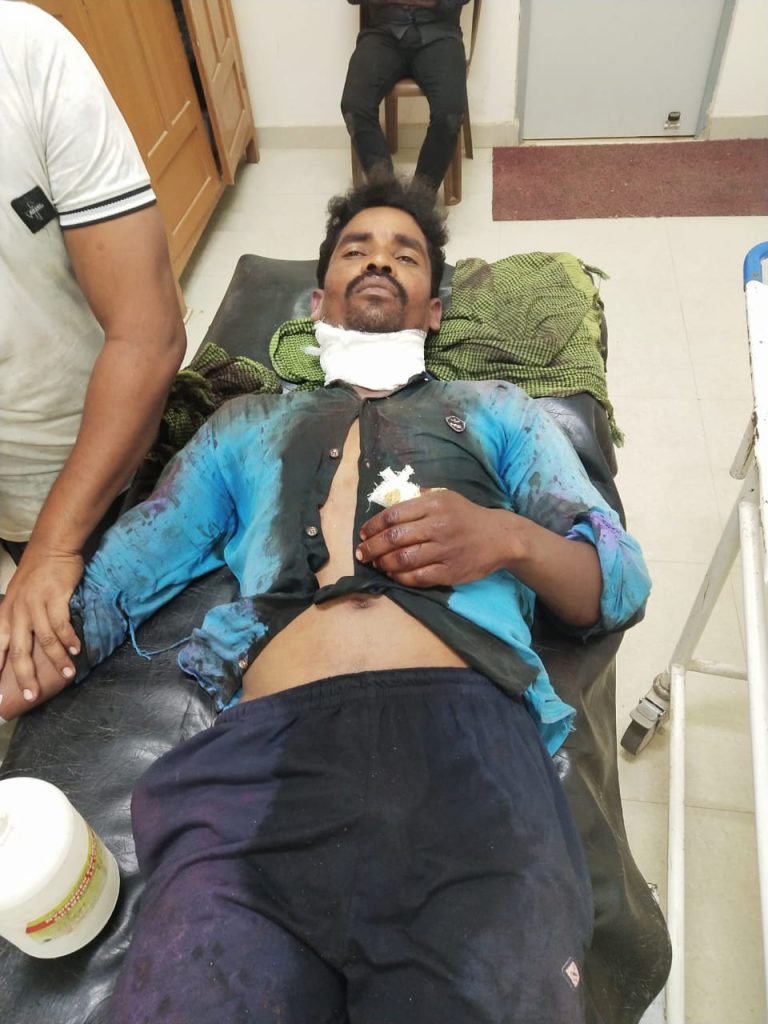 रात के अंधेरे में जेसीबी चालक पर बदमाशों ने किया हमला