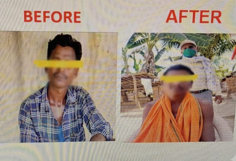 शरीर पर सफेद या सुन्न चकत्ते, सुन्नपन अथवा पलक बंद न होने जैसे लक्षण दिखने पर नजदीकी स्वास्थ्य केंद्र में जांच कराने की अपील